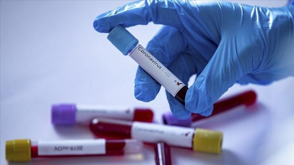 فرنسا تسجل أول إصابة بالطفرة البريطانية من كوفيد-19