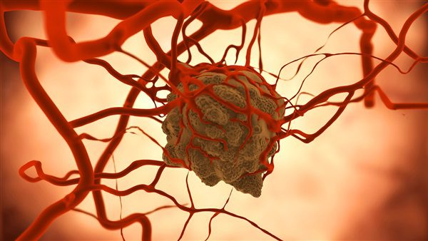 دراسة اكتشاف خلايا الأوعية الدموية المسببة للالتهابات المزمنة بين البدناء | MCG24 | موقع إلكتروني مغربي شامل متجدد على مدار الساعة دراسة: اكتشاف خلايا الأوعية الدموية المسببة للالتهابات المزمنة بين البدناء