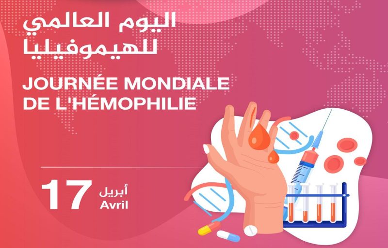 72205574-50251362 | MCG24 | موقع إلكتروني مغربي شامل متجدد على مدار الساعة