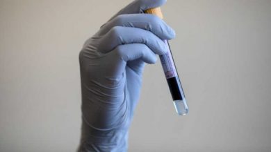 CORONAVIRUS-BRITAIN-NHS | MCG24 | موقع إلكتروني مغربي شامل متجدد على مدار الساعة كورونا