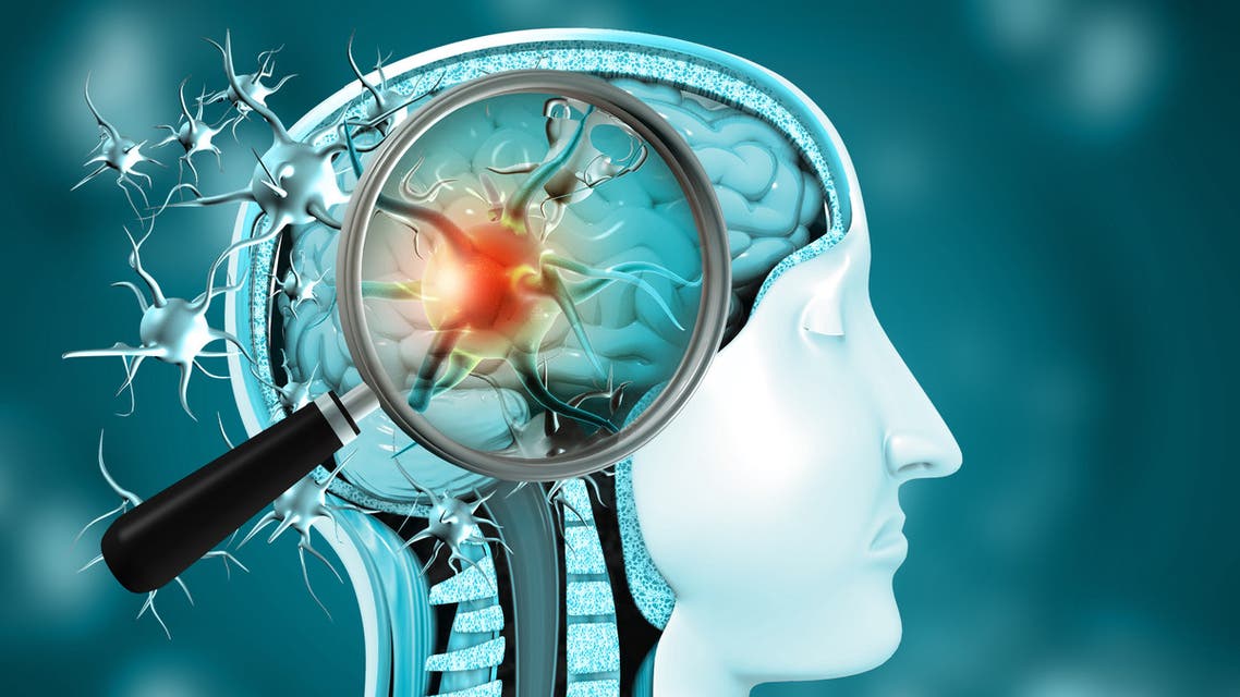 دراسة: تلف الأوعية الدموية والالتهاب في أدمغة مرضى فيروس" كورونا"