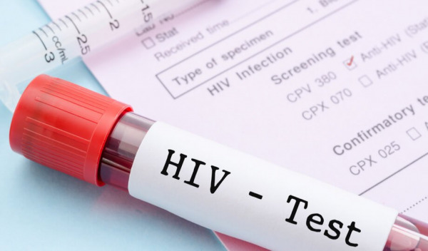HIV_Video | MCG24 | موقع إلكتروني مغربي شامل متجدد على مدار الساعة