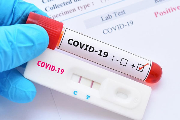 covid_19 | MCG24 | موقع إلكتروني مغربي شامل متجدد على مدار الساعة