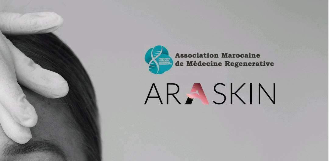 العلاج بالاكسوزوم Exosome