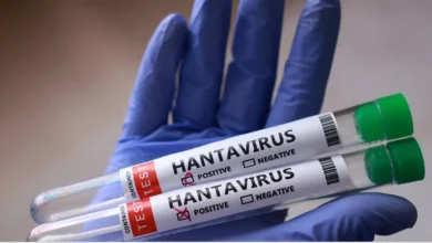 738319 | MCG24 | موقع إلكتروني مغربي شامل متجدد على مدار الساعة Gloved hand holding two hantavirus test tubes showing positive and negative checkboxes with red TEST label on the side.
