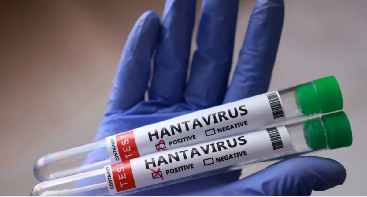 738319 | MCG24 | موقع إلكتروني مغربي شامل متجدد على مدار الساعة Gloved hand holding two hantavirus test tubes showing positive and negative checkboxes with red TEST label on the side.