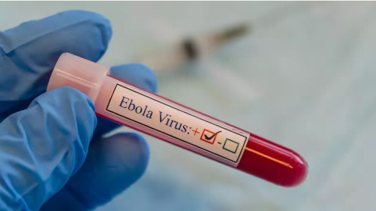 Gloved hand holding a test tube with red liquid labeled 'Ebola Virus' and a checked checkbox symbol on the label.