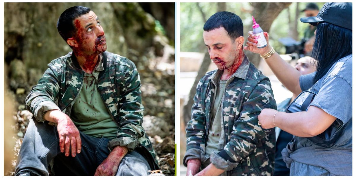 Man in camouflage jacket sits outdoors with blood on his face and hands (prop injuries).