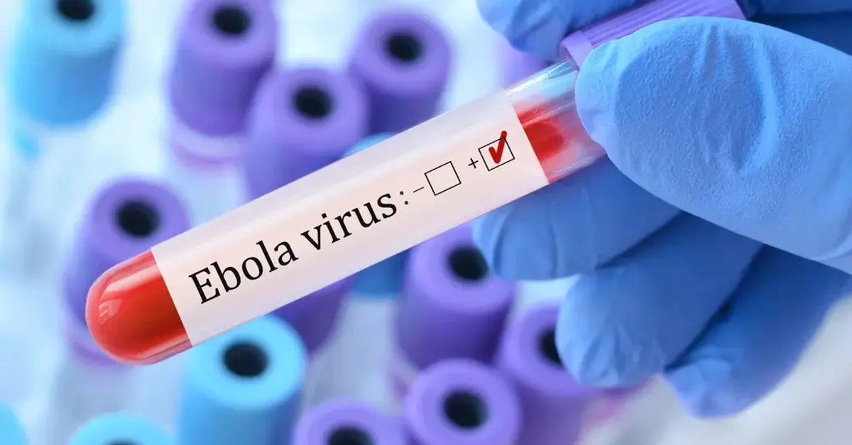 Gloved hand holding a test tube labeled Ebola virus, containing red liquid and a positive checkbox mark.